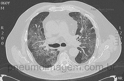 CASO CLÍNICO #10 CASO CLÍNICO #10